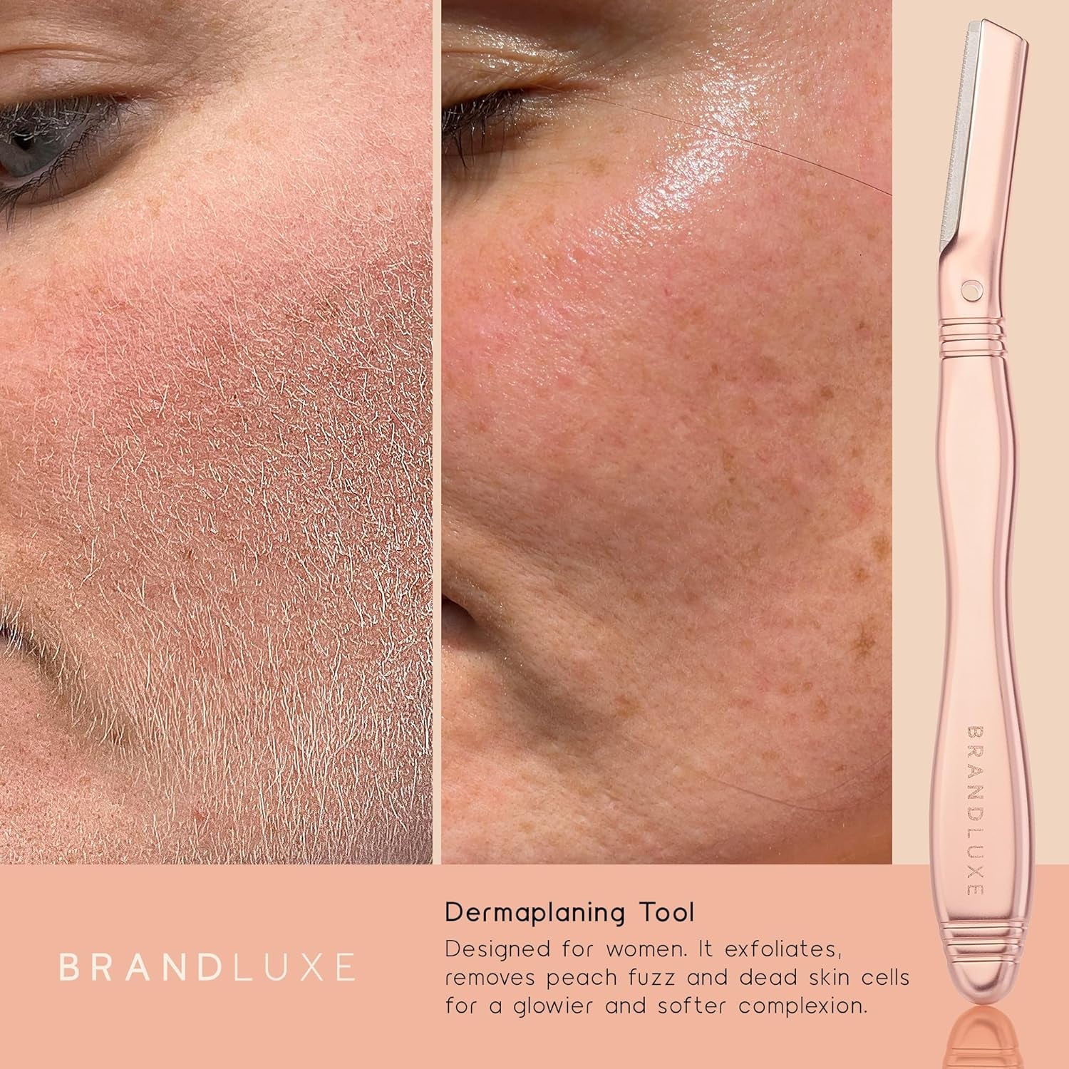 Dermaplaning Tool for Face, Eyebrow Shaping, Hair Removal and Exfoliation. Eco-Friendly Design. Includes 3 Swedish Stainless Steel Blades in Rosegold (Starter Kit)