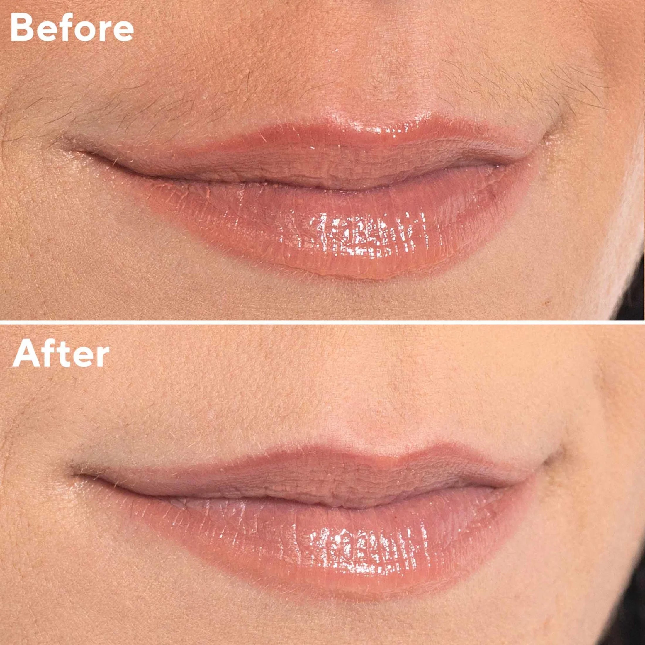 Finishing Touch  Facial Hair Remover for Women, Rose Gold Electric Face Razor with LED Light