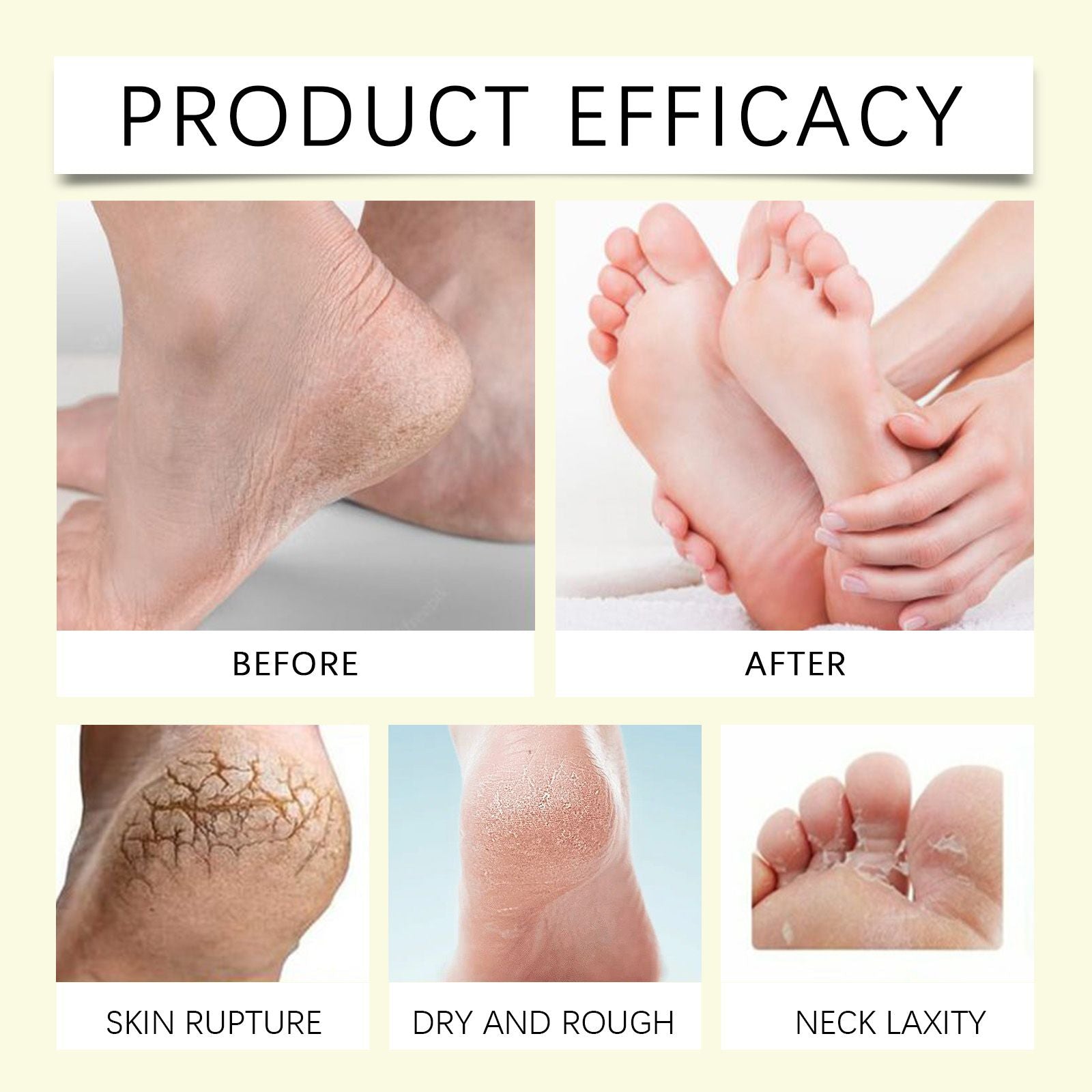 Moisturizing Foot Care Stick